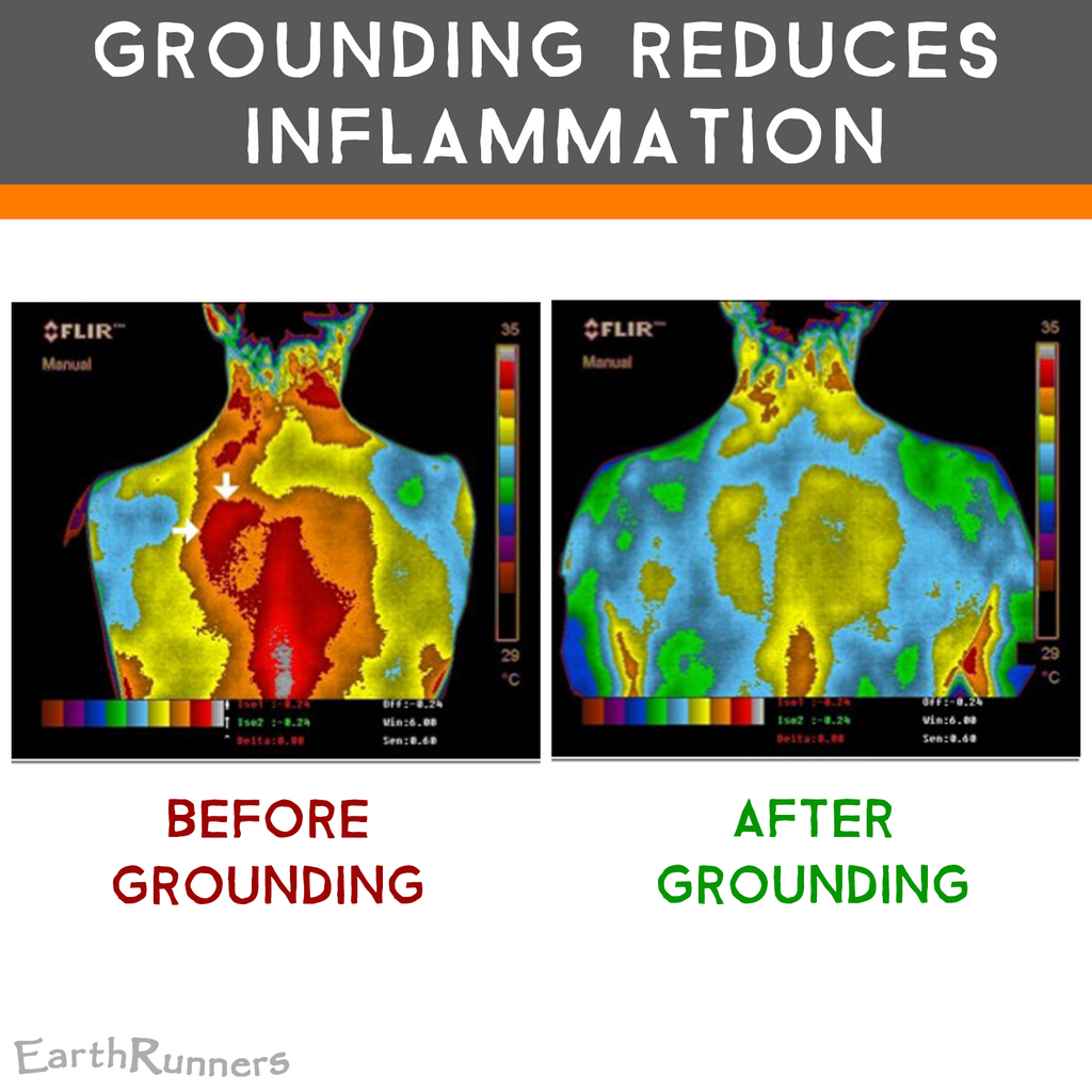 grounding reduces inflammation