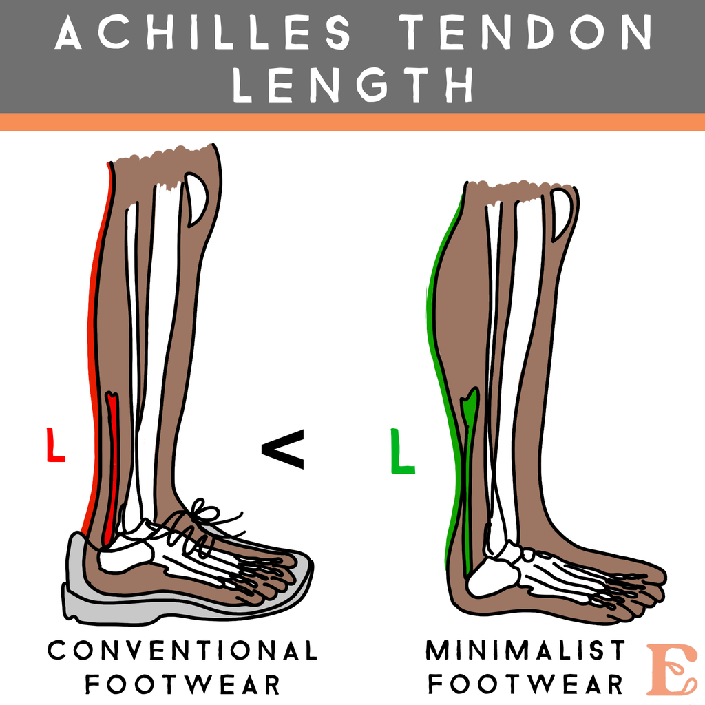 achilles tendon length by shoe choice