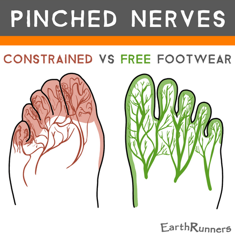 shoes pinch foot nerves
