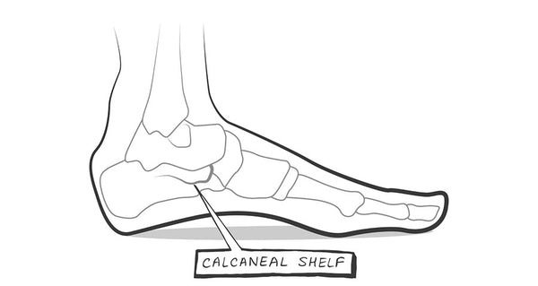Calcaneal shelf area of foot