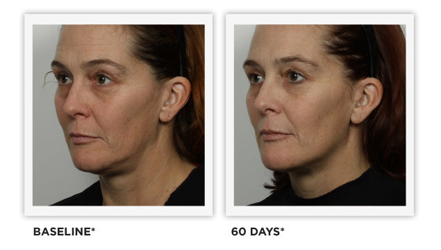 Clinically Tested - images - Tighter, Lifted Skin, Defined Jawline, Smoothed Wrinkles