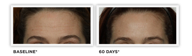 Clinically Tested - images - Diminished Wrinkles