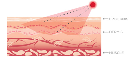 Image of Red Light Therapy - What It Does