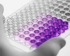 ELISA Kit for Actin Gamma 2, Smooth Muscle (ACTg2) - Human