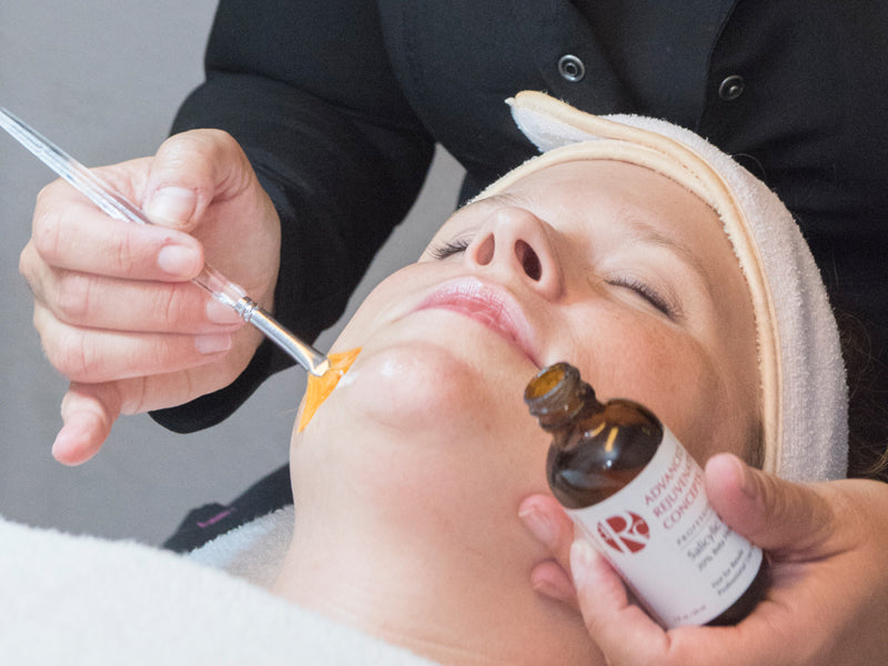 What are the benefits of glycolic peels
