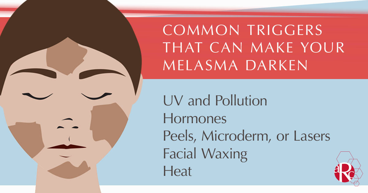 Melasma triggers and how you can stop them