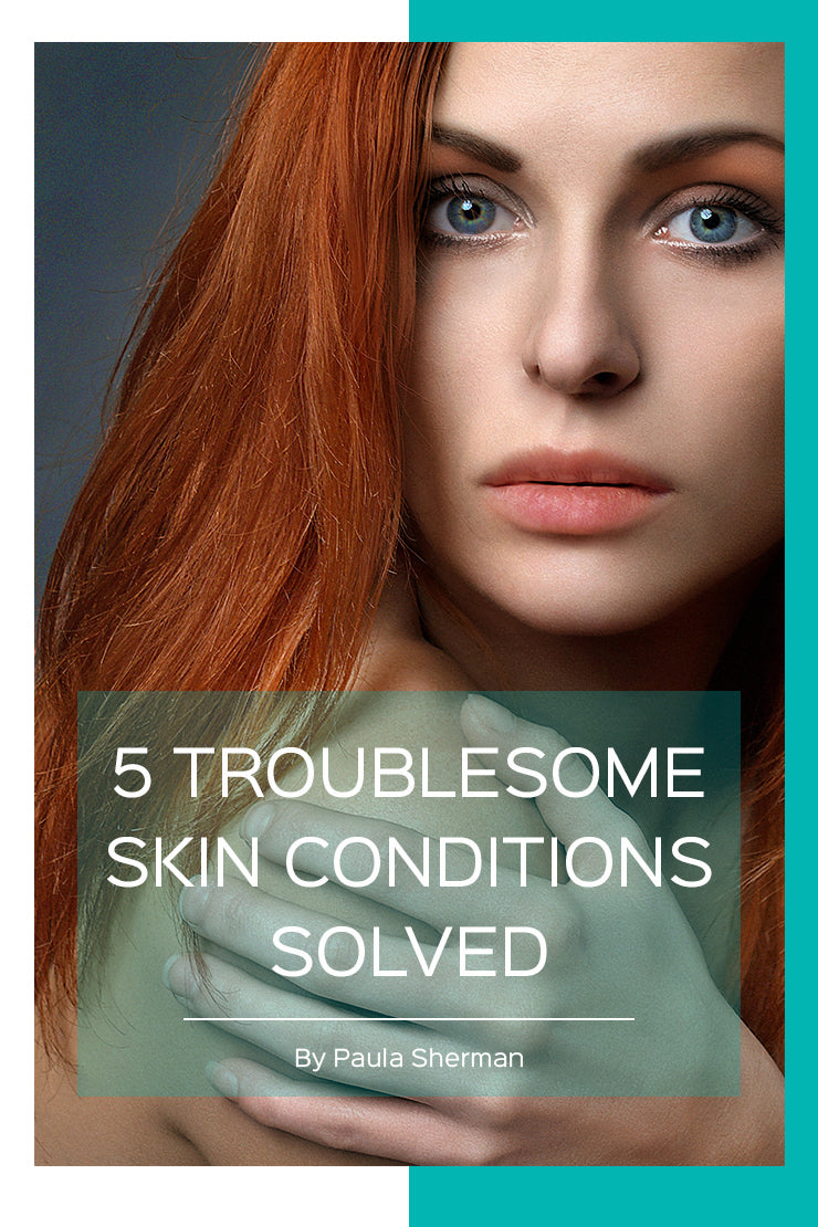 5 troublesome skin conditions solved