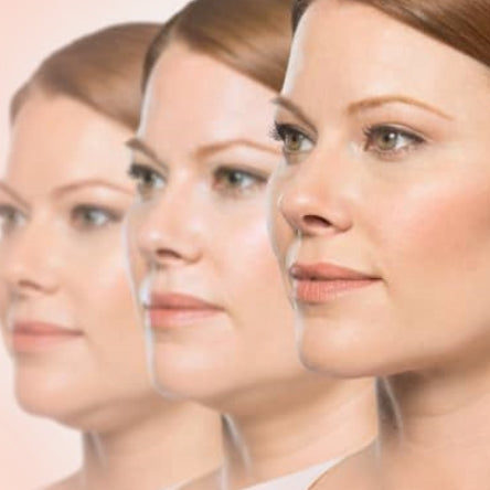 KYBELLA Difference