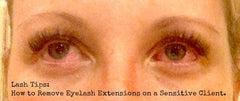 Redness from eyelash extension glue