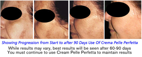 cpp cream can be the natural answer to hyperpigmentation