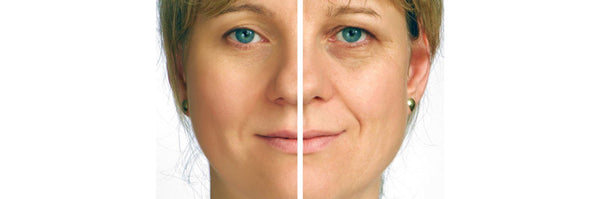 You can fight wrinkles without radical methods