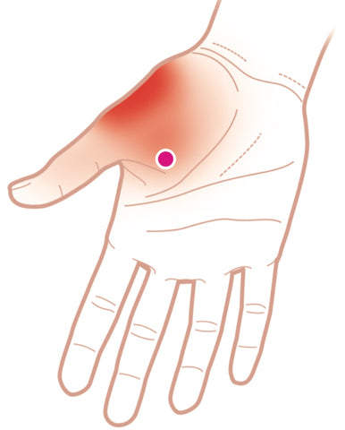 Adductor Pollicis Trigger Points
