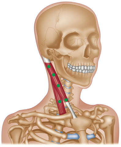 Sternocleidomastoideus (SCM) Trigger Points