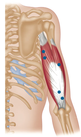 Triceps Trigger Points