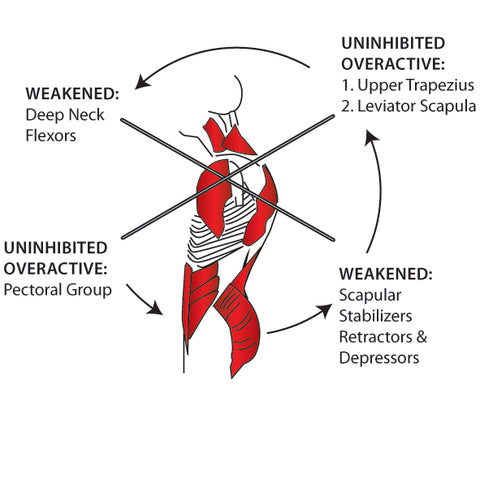 Upper Crossed Pattern