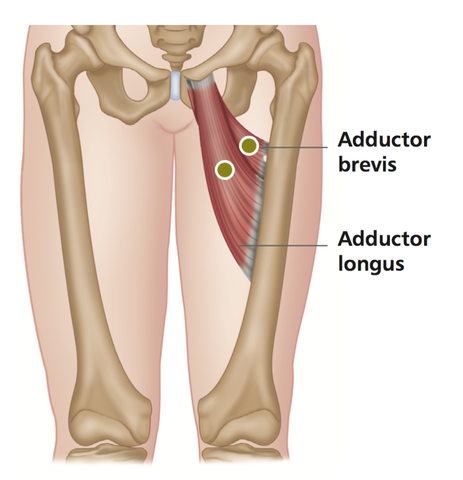 Hip Adductors Trigger Points