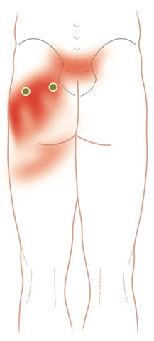 Trigger Point Therapy - Piriformis Syndrome