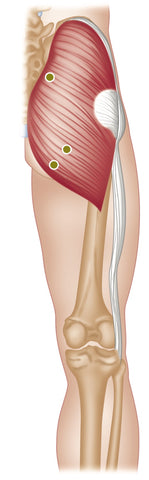 Gluteus Maximus Trigger Points