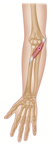 Pronator Teres Trigger Points