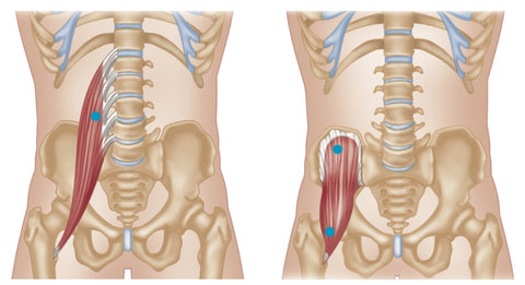 Psoas Major (Left) and Iliacus (Right) Trigger Points