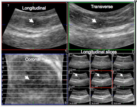 Trigger Point Ultrasound Imaging