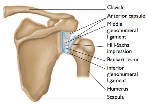 Dislocation of the shoulder