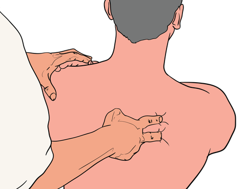 Rhomboid Trigger Points