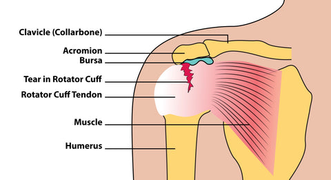 Rotator Cuff Trigger Points