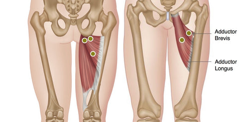 Hip Adductor Trigger Points