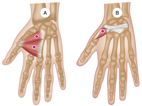 Adductor and Opponens Pollicis Trigger Points