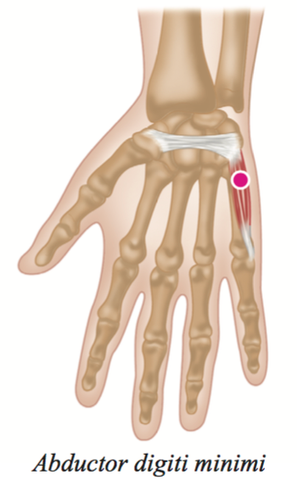 hand Muscle Trigger Points