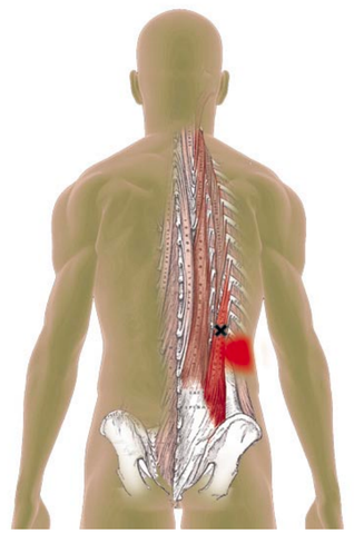 Iliocostalis Trigger Point