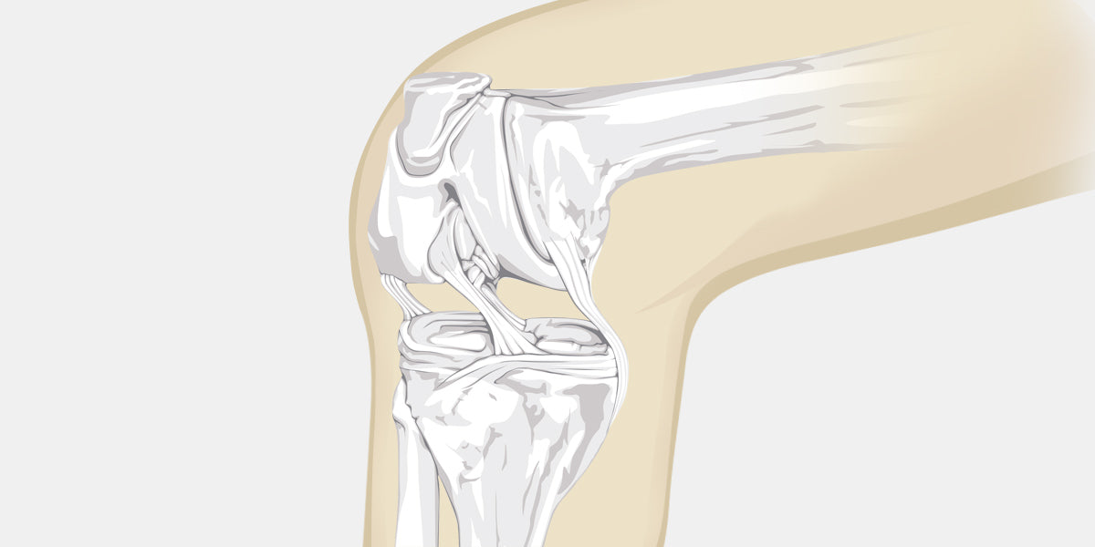 Dislocated Knee Illustration