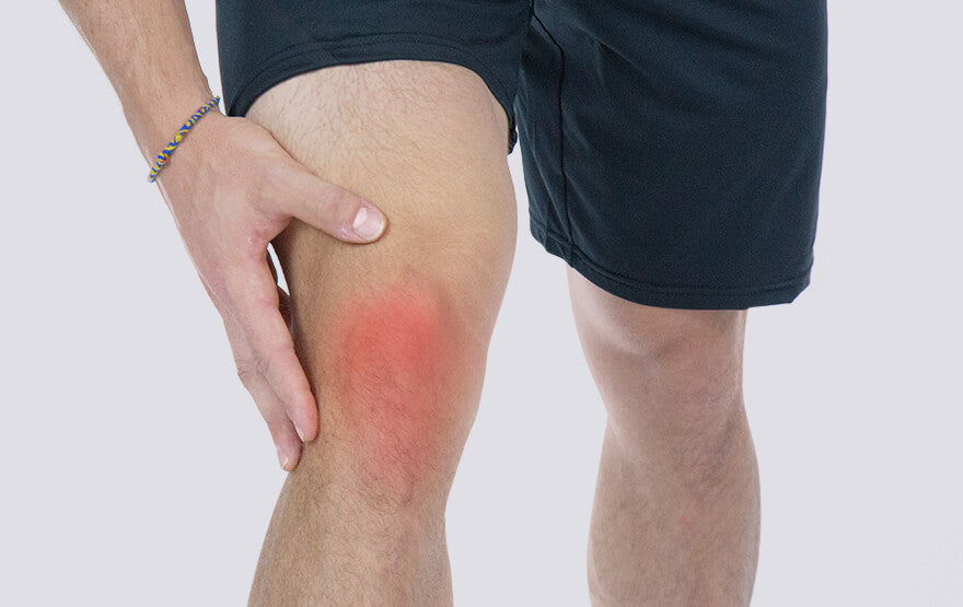 Knee Bursitis Pain