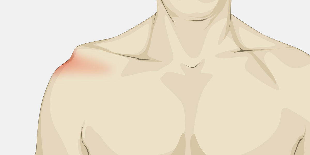 Shoulder-Separation-Symptom