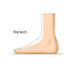 flat arch