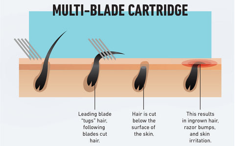 Graphic of hair follicles under skin