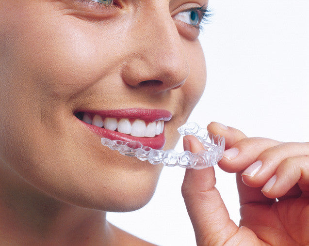 Clear Braces vs Metal Braces