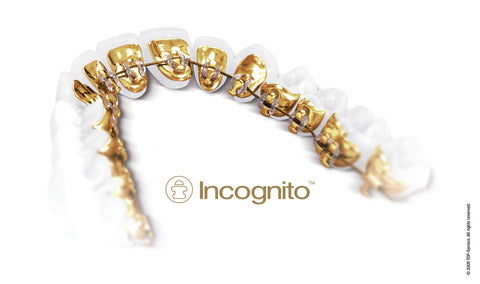 incognito lingual braces | Manchester Orthodontics