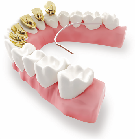 Lingual Braces | Manchester Orthodontics 