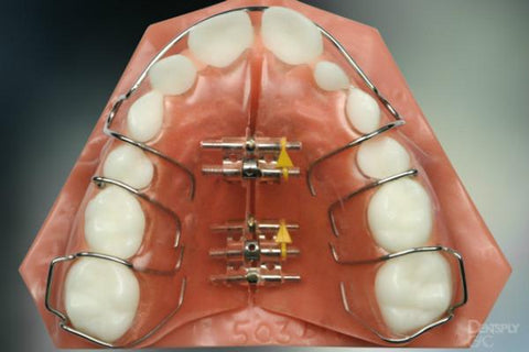 Functional Braces