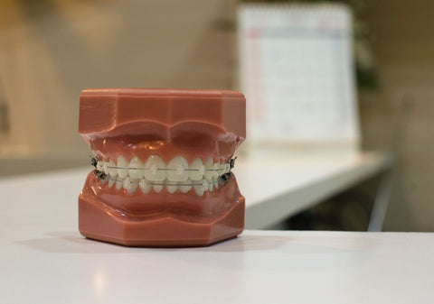 brace care | Manchester Orthodontics