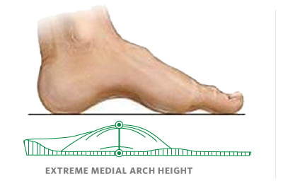 Extreme arch insole