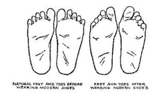 Damaging effects of improper footwear over time.