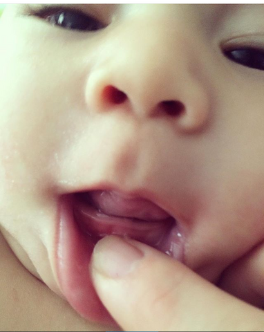 Baby teething