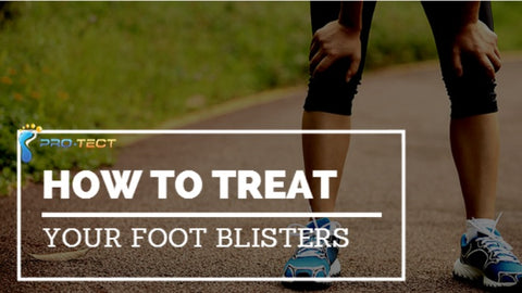 Treating Your Foot Blisters