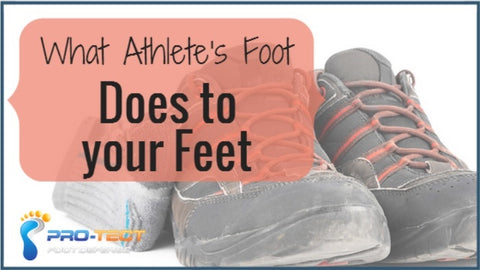 athletes foot wear