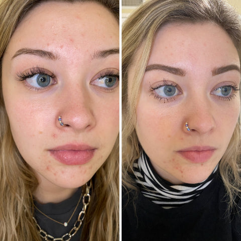 before and after using ORGAID Youth Serum