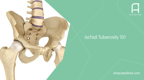 The ischial tuberosity helps support your body weight when wearing a prosthesis and can become inflamed from overuse.