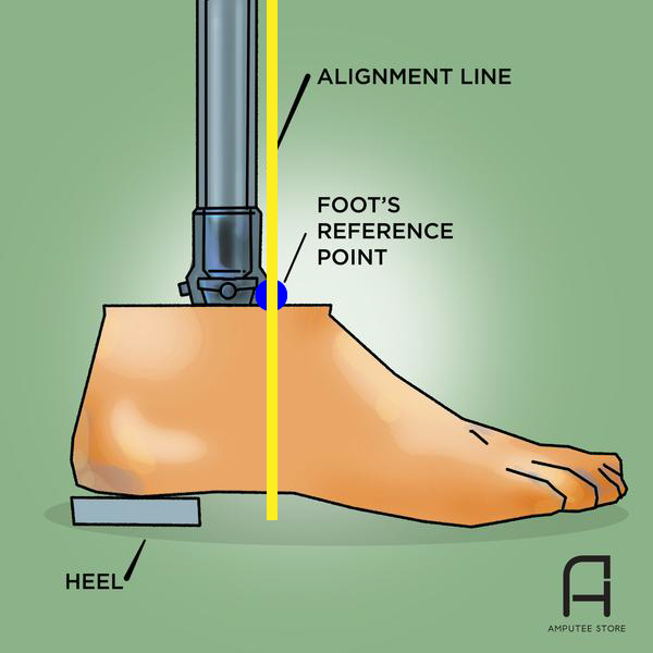 Prosthetic foot alignment line should fall through the reference point.